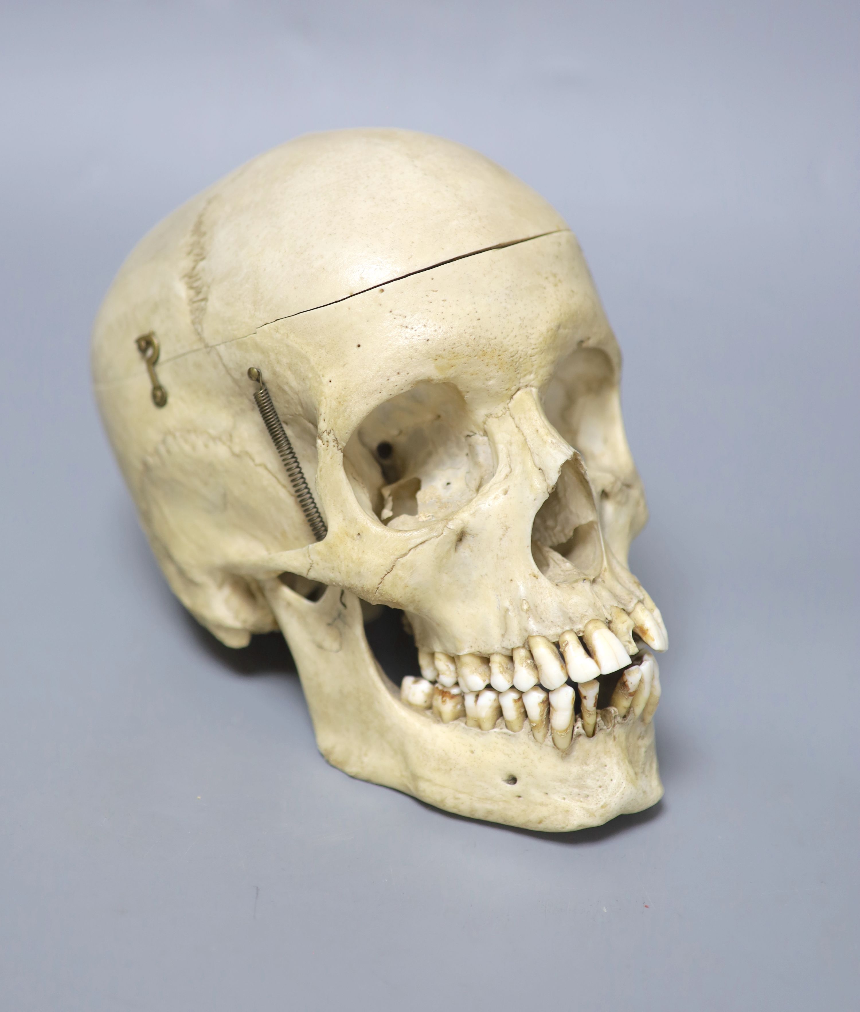 A human skull, with removable cranium and sprung jaw, height 16cm